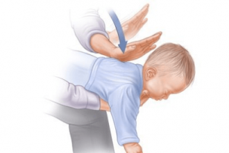 Cách sơ cứu khi trẻ sặc sữa