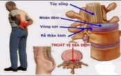 Đông y- chữa bệnh chữa tận gốc (số 11)